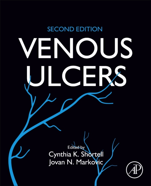Venous Ulcers, Paperback / softback Book