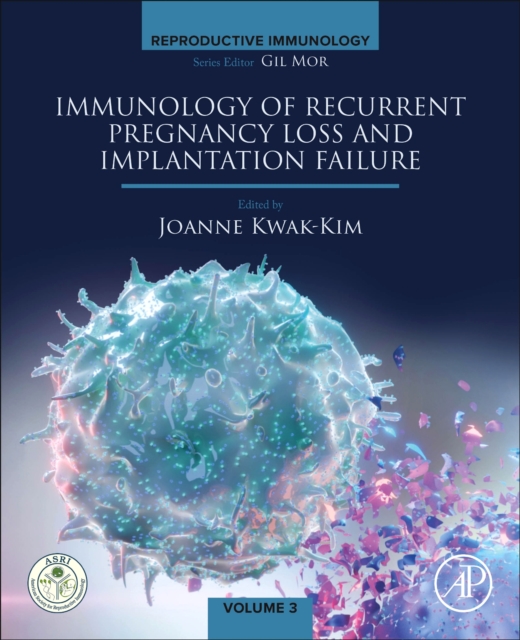 Immunology of Recurrent Pregnancy Loss and Implantation Failure, Paperback / softback Book
