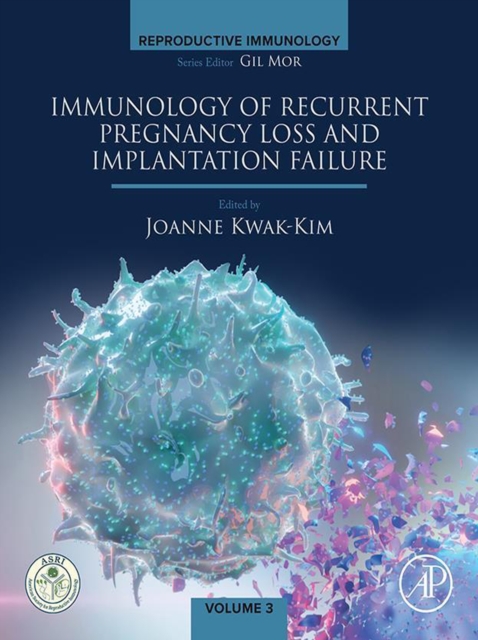 Immunology of Recurrent Pregnancy Loss and Implantation Failure, EPUB eBook