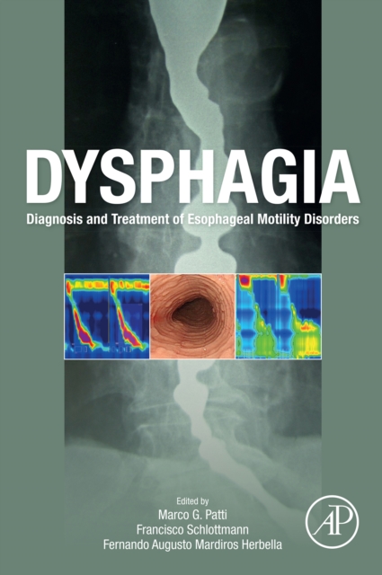 Dysphagia : Diagnosis and Treatment of Esophageal Motility Disorders, EPUB eBook
