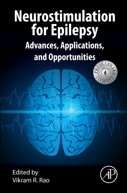 Neurostimulation for Epilepsy : Advances, Applications and Opportunities, Hardback Book