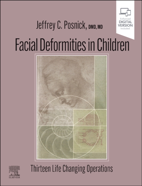 Facial Deformities in Children : Thirteen Life Changing Operations, Hardback Book