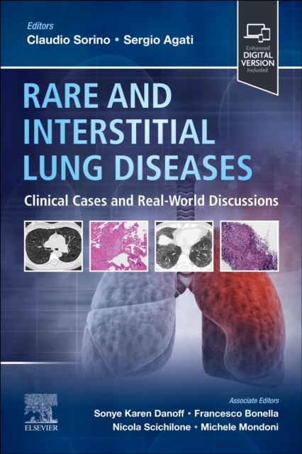 Rare and Interstitial Lung Diseases : Clinical Cases and Real-World Discussions, Paperback / softback Book