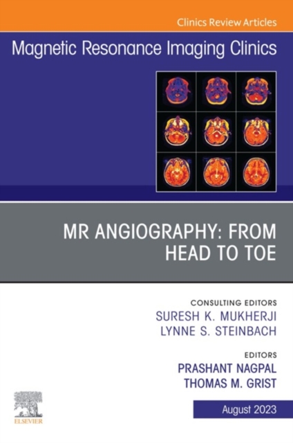 MR Angiography: From Head to Toe, An Issue of Magnetic Resonance Imaging Clinics of North America, E-Book, EPUB eBook