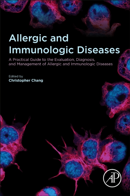 Allergic and Immunologic Diseases : A Practical Guide to the Evaluation, Diagnosis and Management of Allergic and Immunologic Diseases, EPUB eBook