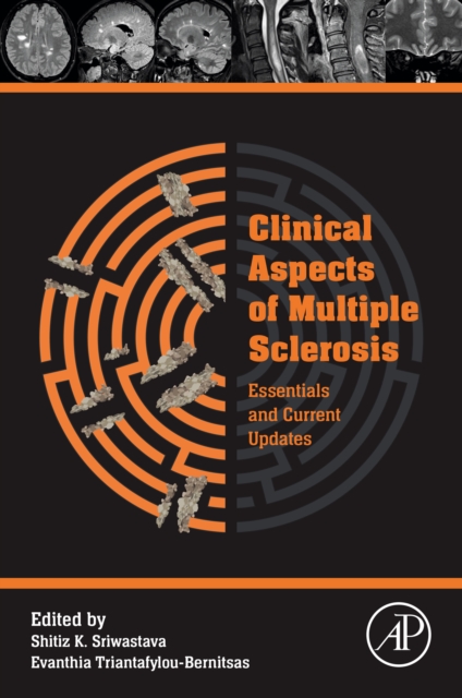 Clinical Aspects of Multiple Sclerosis Essentials and Current Updates, EPUB eBook