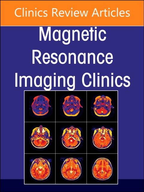 MR Imaging of the Adnexa, An Issue of Magnetic Resonance Imaging Clinics of North America : Volume 31-1, Hardback Book