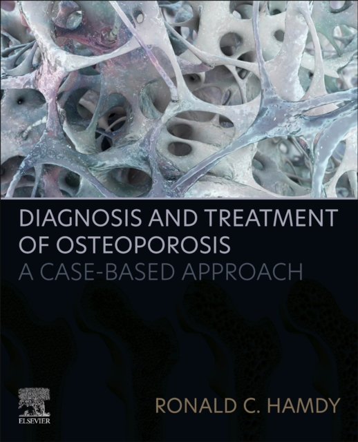 Diagnosis and Treatment of Osteoporosis : A Case-Based Approach, Paperback / softback Book