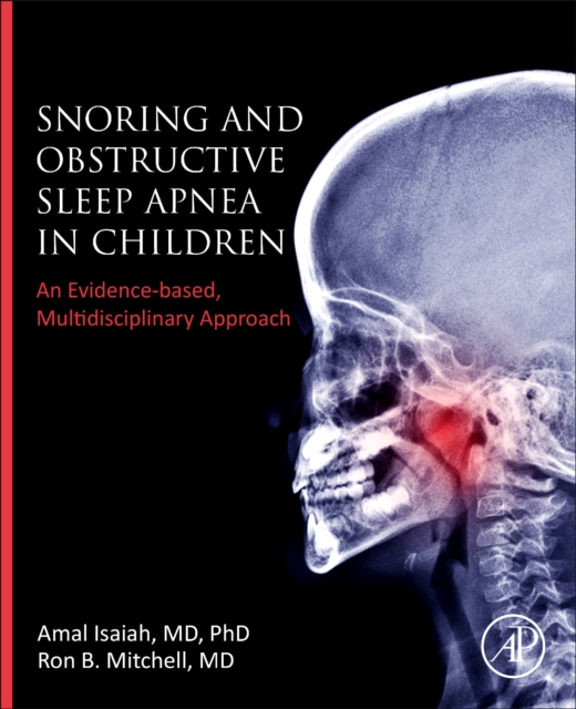 Snoring and Obstructive Sleep Apnea in Children : An Evidence-Based, Multidisciplinary Approach, Paperback / softback Book