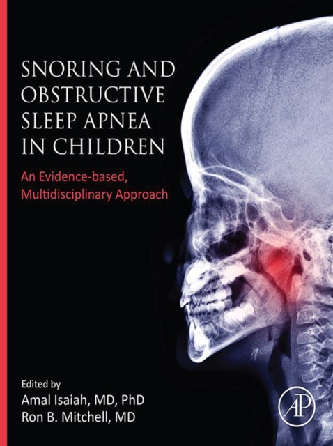Snoring and Obstructive Sleep Apnea in Children : An Evidence-Based, Multidisciplinary Approach, EPUB eBook