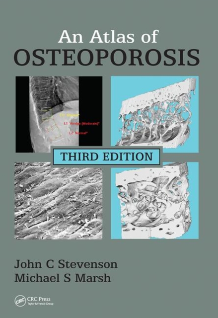 An Atlas of Osteoporosis, Paperback / softback Book