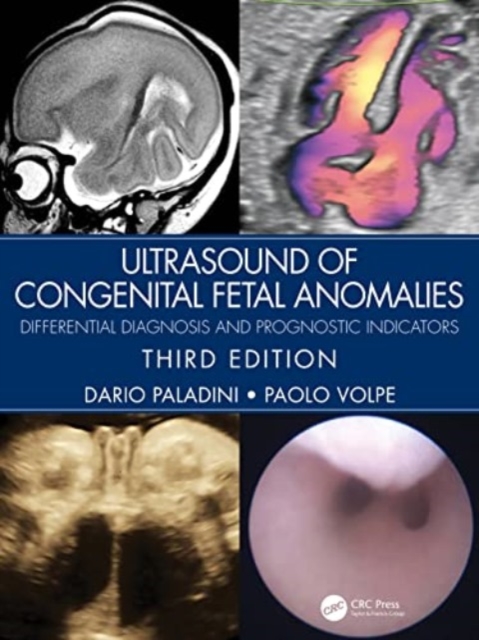 Ultrasound of Congenital Fetal Anomalies : Differential Diagnosis and Prognostic Indicators, Hardback Book