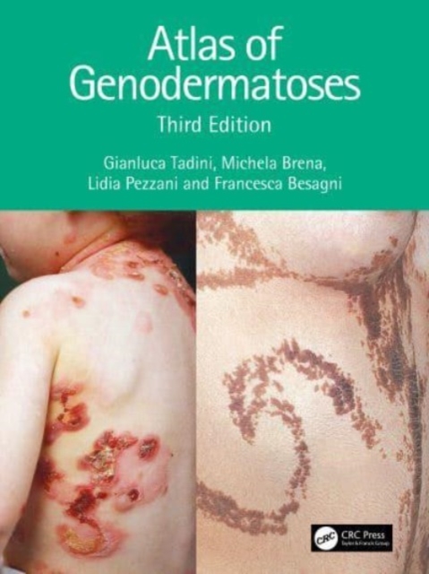 Atlas of Genodermatoses, Paperback / softback Book