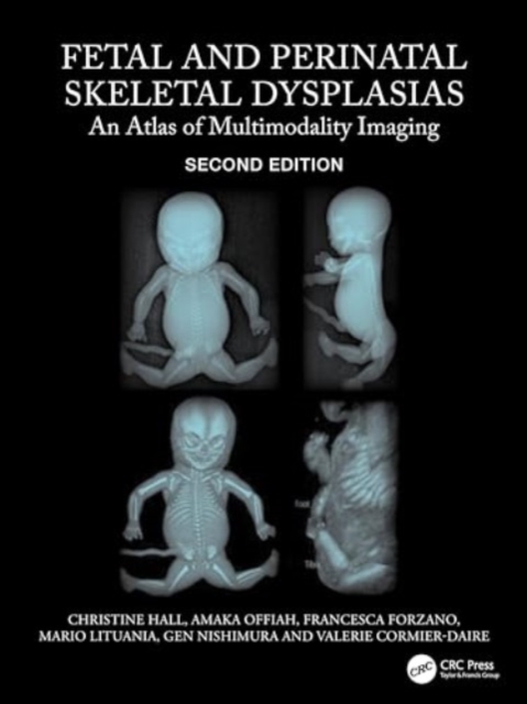 Fetal and Perinatal Skeletal Dysplasias : An Atlas of Multimodality Imaging, Hardback Book