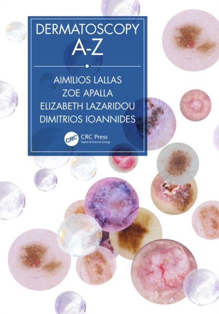 Dermatoscopy A-Z, EPUB eBook