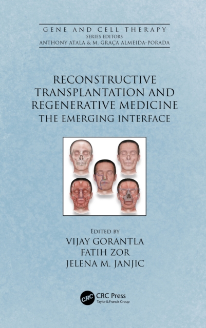 Reconstructive Transplantation and Regenerative Medicine : The Emerging Interface, PDF eBook