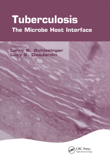 Tuberculosis : The Microbe Host Interface, EPUB eBook