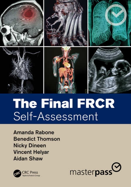 The Final FRCR : Self-Assessment, EPUB eBook