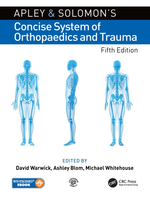 Apley and Solomon’s Concise System of Orthopaedics and Trauma, EPUB eBook