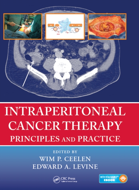 Intraperitoneal Cancer Therapy : Principles and Practice, EPUB eBook