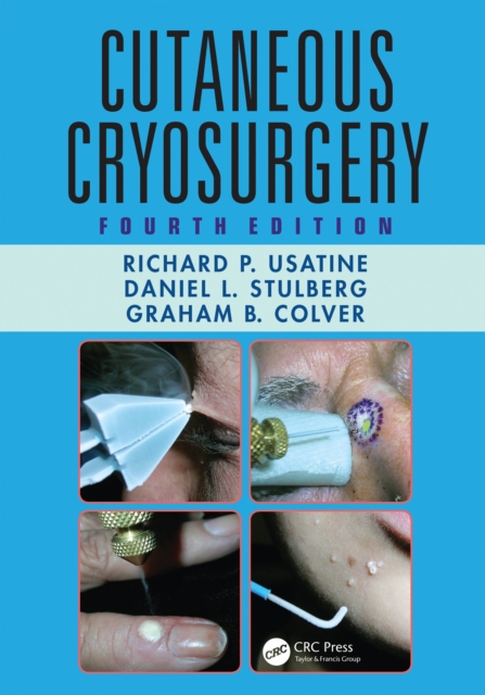 Cutaneous Cryosurgery, EPUB eBook
