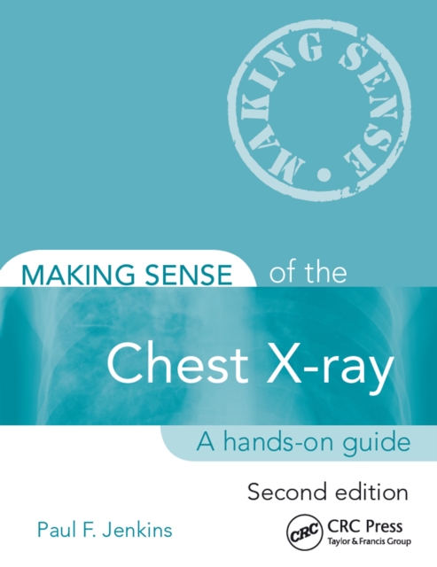 Making Sense of the Chest X-ray : A hands-on guide, EPUB eBook
