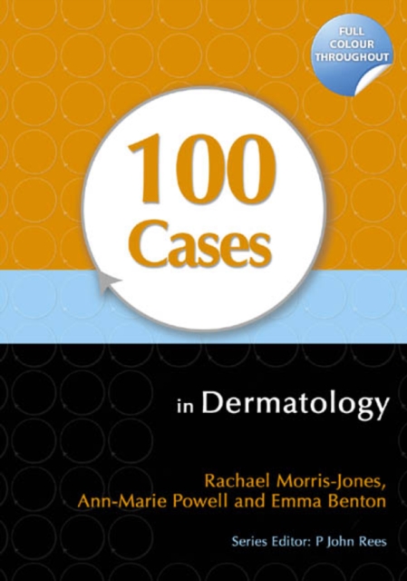 100 Cases in Dermatology, EPUB eBook