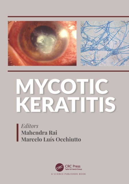 Mycotic Keratitis, EPUB eBook
