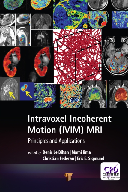 Intravoxel Incoherent Motion (IVIM) MRI : Principles and Applications, EPUB eBook