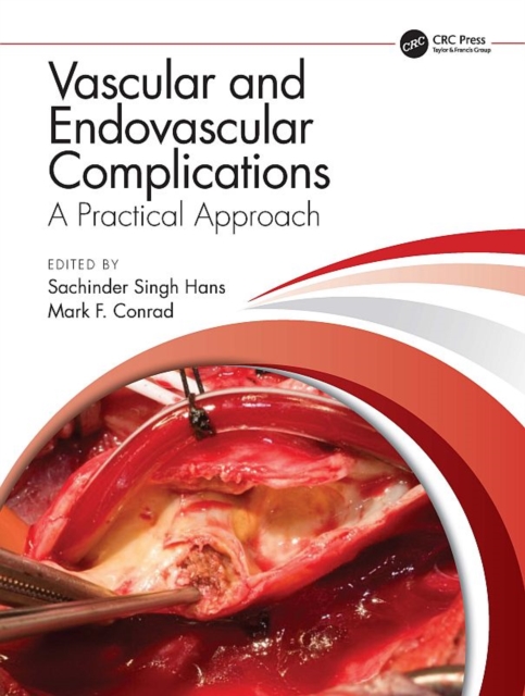 Vascular and Endovascular Complications: A Practical Approach, PDF eBook