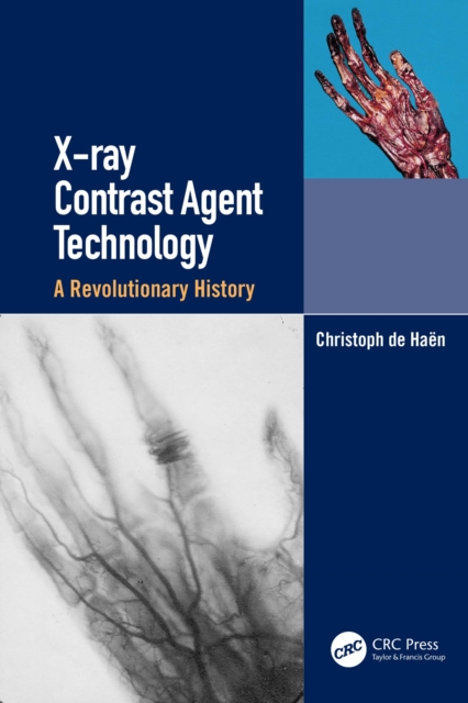 X-ray Contrast Agent Technology : A Revolutionary History, EPUB eBook