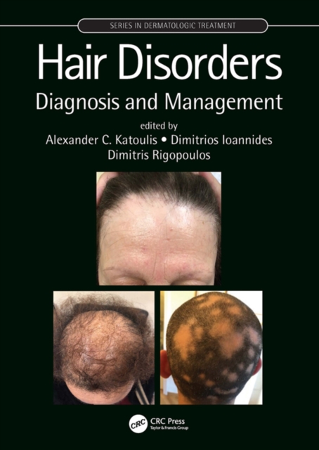 Hair Disorders : Diagnosis and Management, EPUB eBook