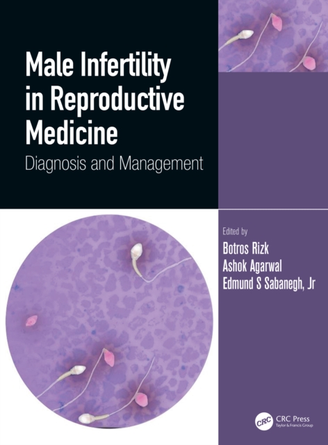 Male Infertility in Reproductive Medicine : Diagnosis and Management, EPUB eBook