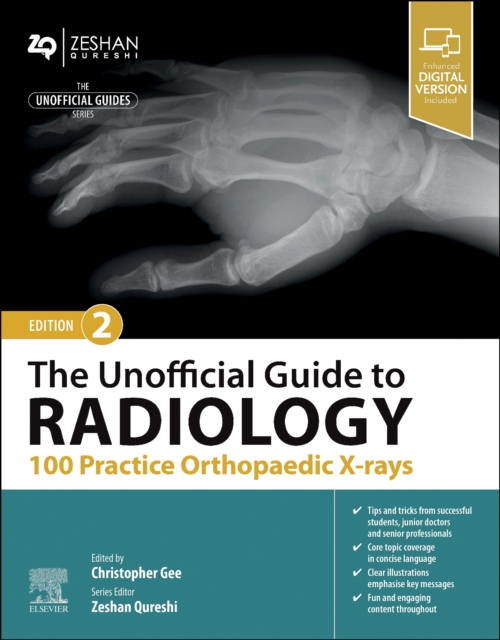 The Unofficial Guide to Radiology: 100 Practice Orthopaedic X-rays, Paperback / softback Book