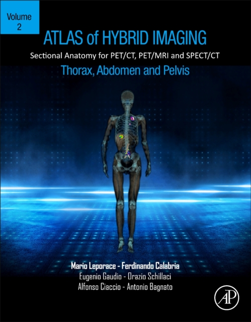 Atlas of Hybrid Imaging Sectional Anatomy for PET/CT, PET/MRI and SPECT/CT Vol. 2: Thorax Abdomen and Pelvis : Sectional Anatomy for PET/CT, PET/MRI and SPECT/CT, Paperback / softback Book