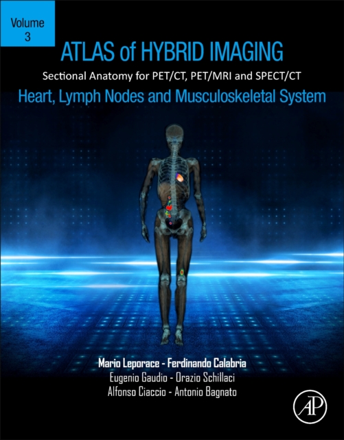Atlas of Hybrid Imaging Sectional Anatomy for PET/CT, PET/MRI and SPECT/CT Vol. 3: Heart, Lymph Node and Musculoskeletal System : Sectional Anatomy for PET/CT, PET/MRI and SPECT/CT, Paperback / softback Book
