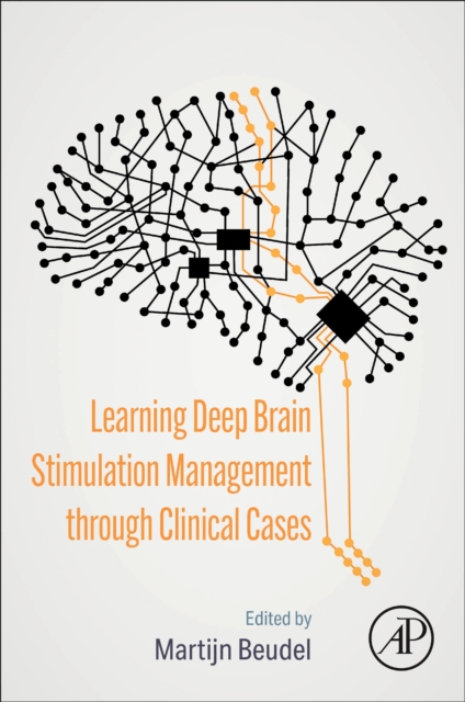 Learning Deep Brain Stimulation Management through Clinical Cases, Paperback / softback Book