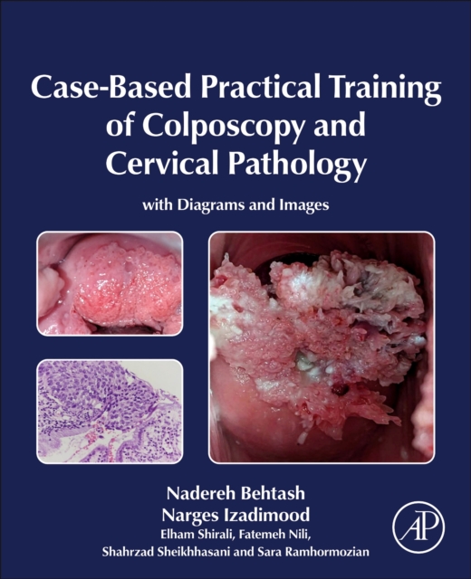 Case-Based Practical Training of Colposcopy and Cervical Pathology : With Diagrams and Images, Hardback Book