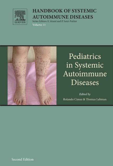 Pediatrics in Systemic Autoimmune Diseases, EPUB eBook