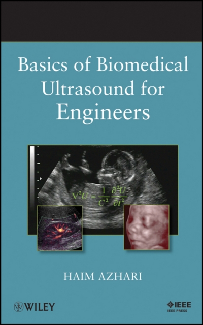 Basics of Biomedical Ultrasound for Engineers, PDF eBook