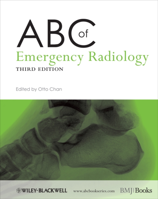 ABC of Emergency Radiology, Paperback / softback Book
