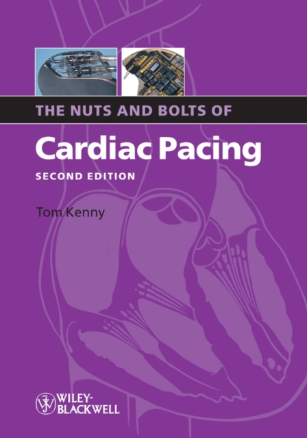 The Nuts and Bolts of Cardiac Pacing, PDF eBook