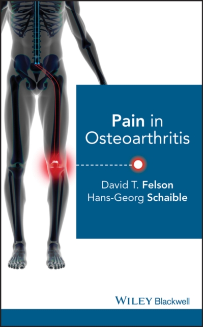 Pain in Osteoarthritis, PDF eBook