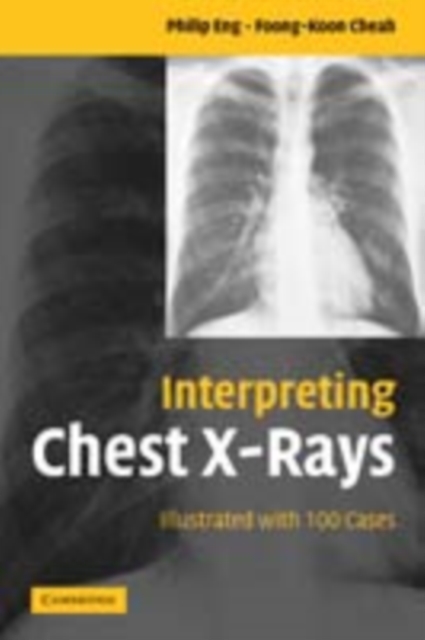 Interpreting Chest X-Rays : Illustrated with 100 Cases, PDF eBook