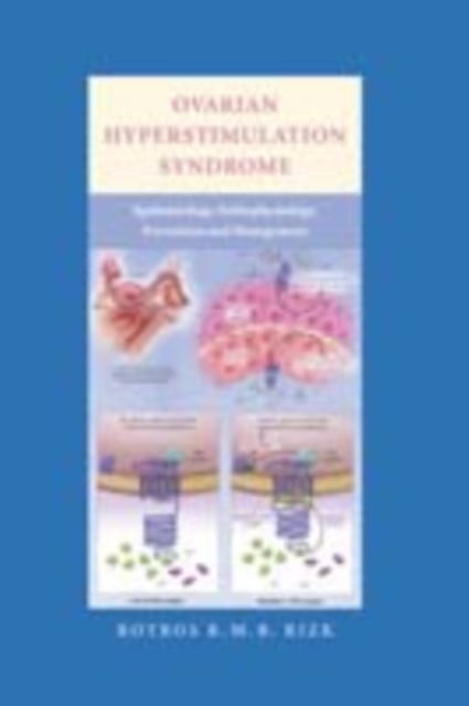 Ovarian Hyperstimulation Syndrome : Epidemiology, Pathophysiology, Prevention and Management, PDF eBook