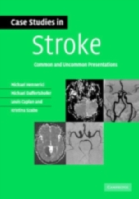 Case Studies in Stroke : Common and Uncommon Presentations, PDF eBook