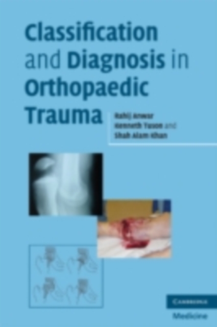 Classification and Diagnosis in Orthopaedic Trauma, PDF eBook