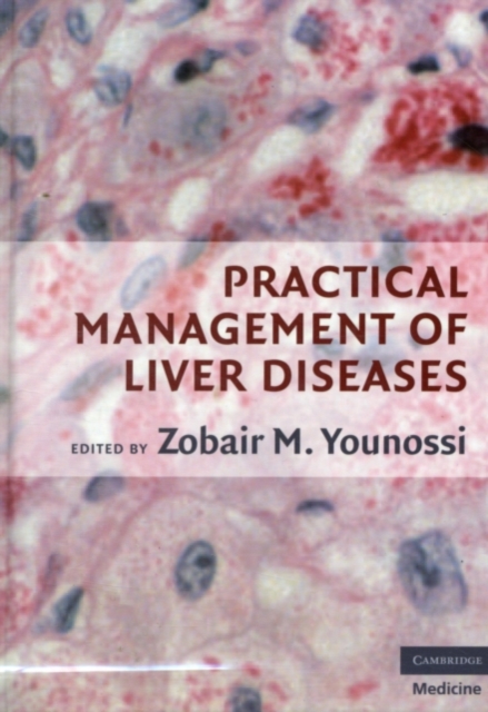 Practical Management of Liver Diseases, PDF eBook