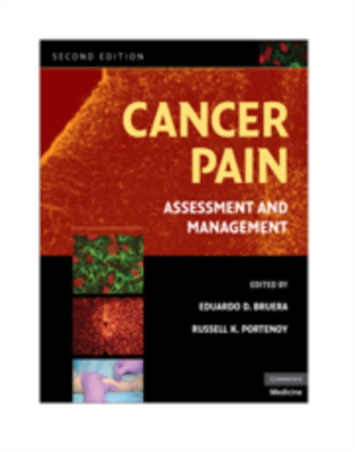 Cancer Pain : Assessment and Management, PDF eBook