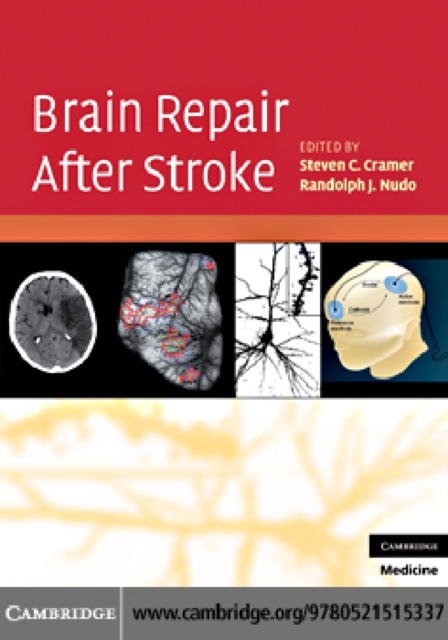Brain Repair After Stroke, PDF eBook